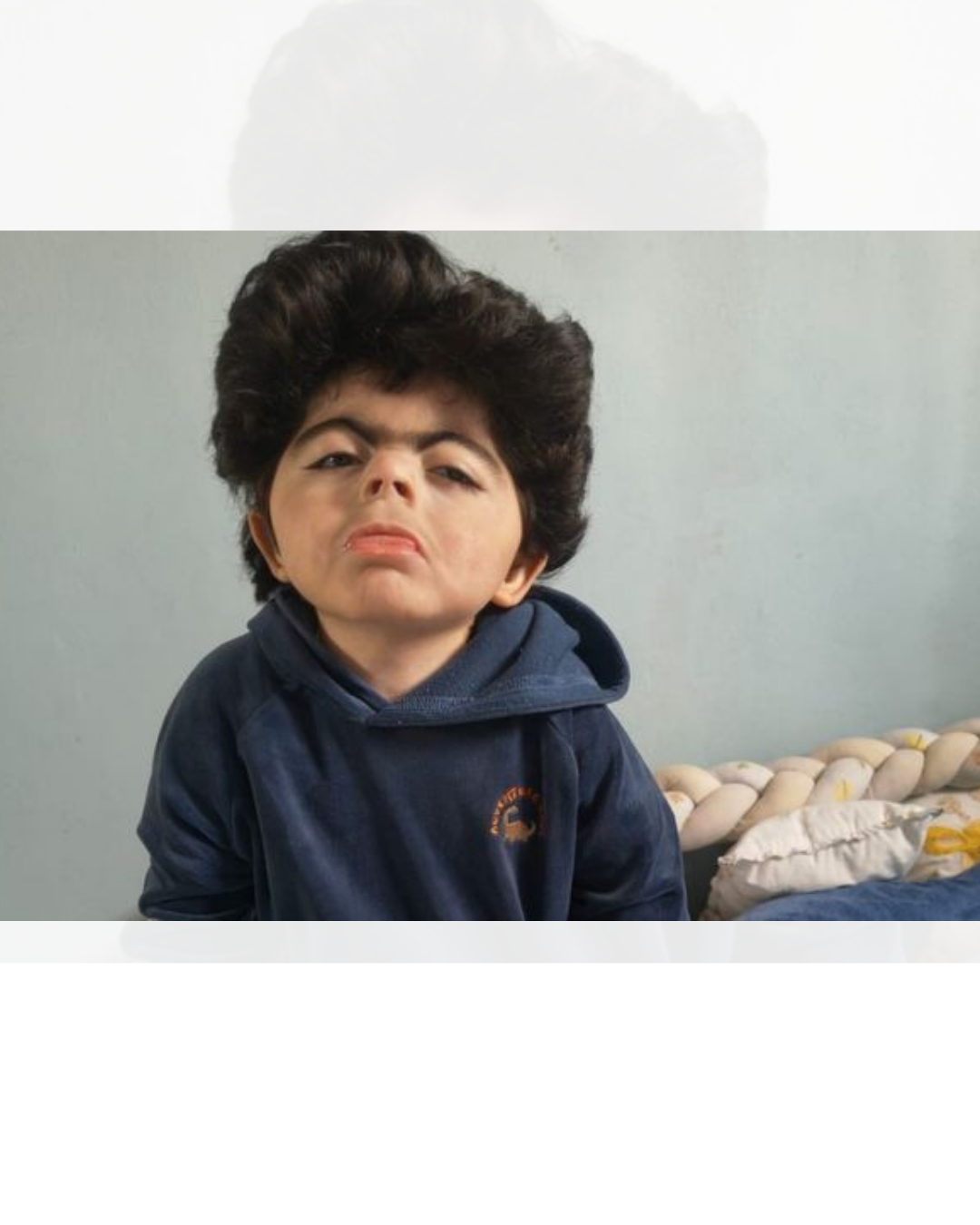 Com apenas 4 anos, Heitor enfrenta síndrome rara e família faz vaquinha para cirurgia 