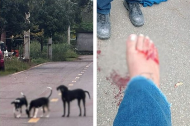 Ataque de cão expõe descaso com a causa animal em Cabreúva